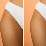 depositphotos_603430672-stock-photo-image-compare-woman-legs-stretch